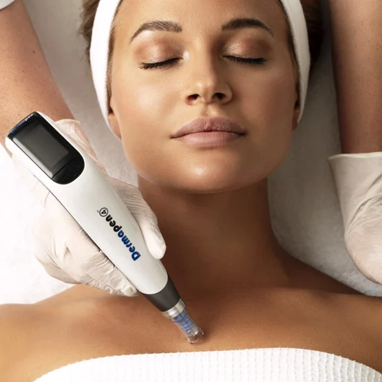 dermapen-sto-laimo- dermapen στο λαιμο