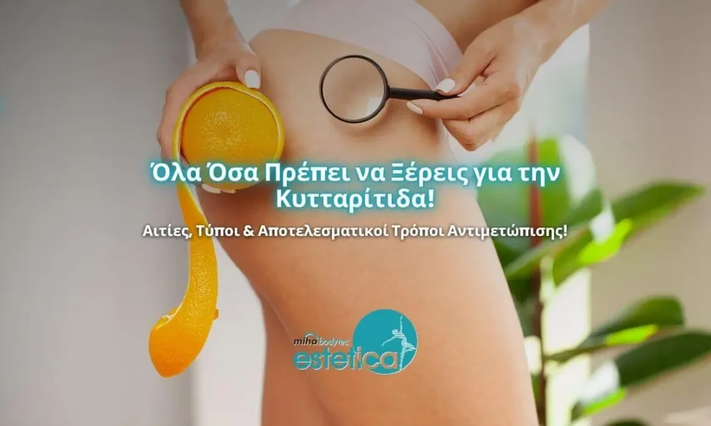 Όλα Όσα Πρέπει να Ξέρεις για την Κυτταρίτιδα